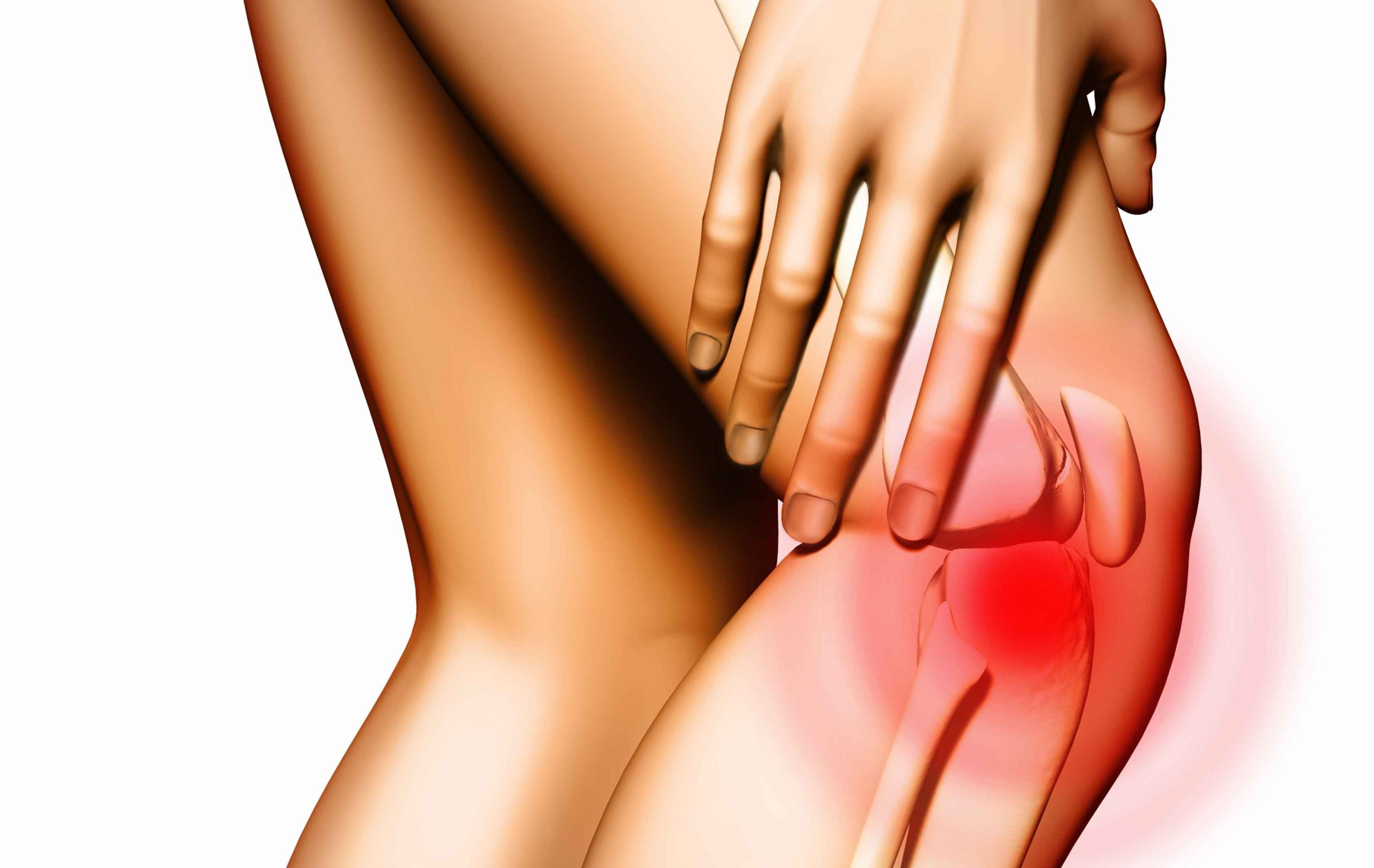 A entorse do joelho acontece quando há rompimento dos ligamentos.