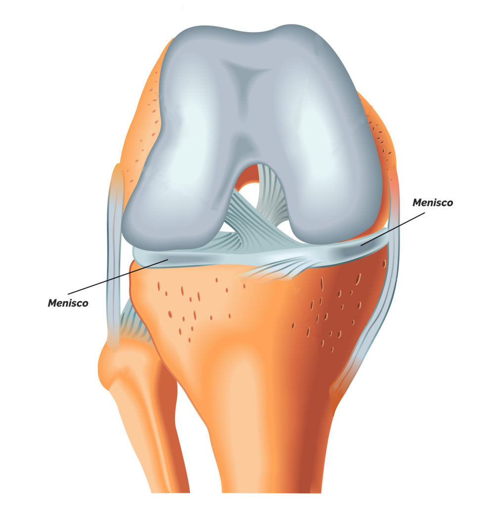 A artroscopia do joelho é um procedimento cirúrgico