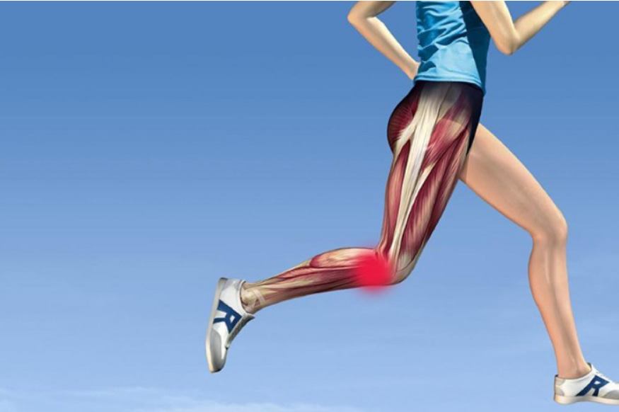 É comum a inflamação da banda iliotibial, feixe fibroso, no joelho de corredor.