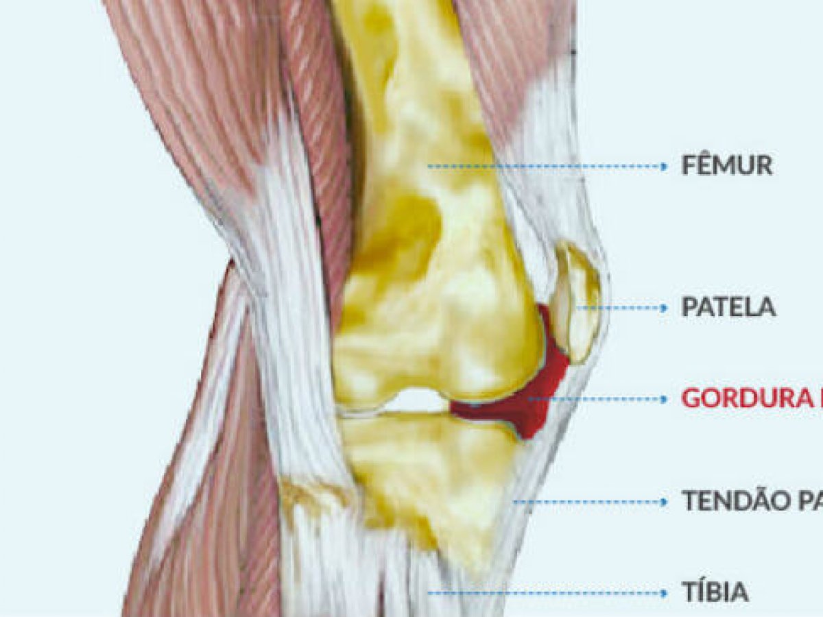 esquema mostrando estrutura do joelho e gordura de hoffa