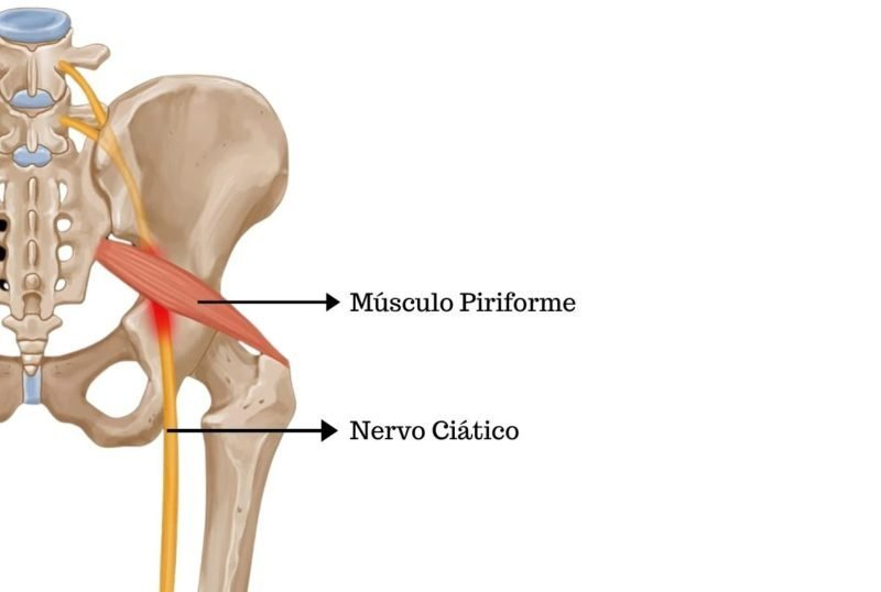 músculo piriforme e nervo ciático